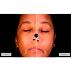 Mesoestetic Dermamelan Treatment pigment Control 30g 1.06oz -Nude Rich Sales lyskin mesoestetic dermamelan results II resultado