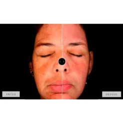 Mesoestetic Dermamelan Treatment pigment Control 30g 1.06oz -Nude Rich Sales lyskin mesoestetic dermamelan results IV resultado