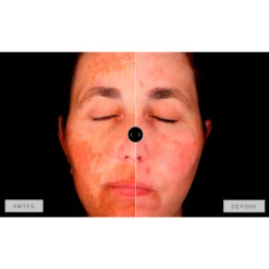 Mesoestetic Dermamelan Treatment pigment Control 30g 1.06oz -Nude Rich Sales lyskin mesoestetic dermamelan results resultado